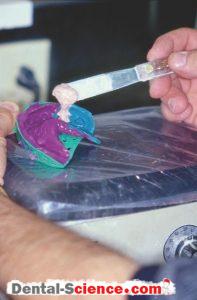 An impression sits on a dental vibrator as it is poured with stone.