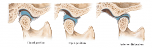 Temporomandibular Joint 