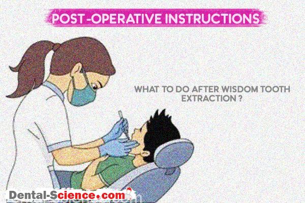 Instructions after wisdom tooth extraction