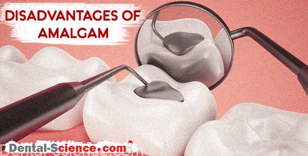 Disadvantages of Amalgam